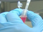 Cancer Vaccine in Laboratory Testing