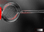 Extraction of the Nucleus from an Egg Cell
