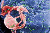 An electron microscopic image of the human immunodeficiency virus on human lymphocytes